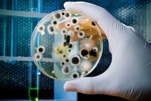 coliform bacteria test in lab petri dish
